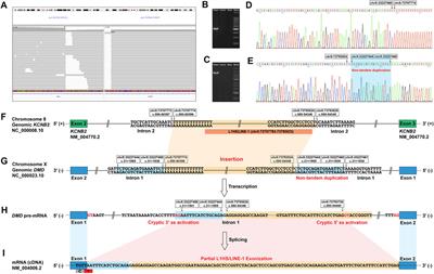 Exonization of a deep intronic long interspersed nuclear element in Becker muscular dystrophy